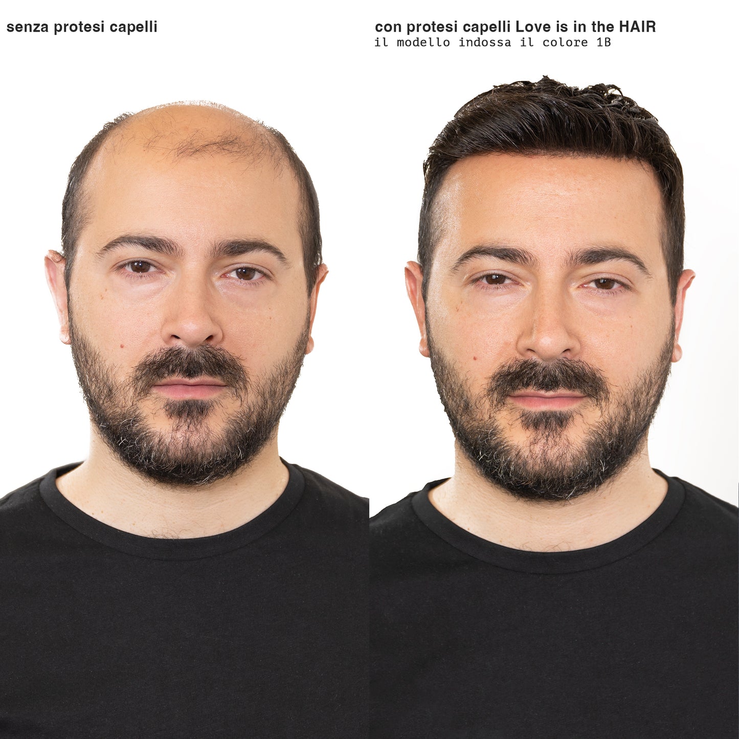 PROTESI CAPELLI BRONZE