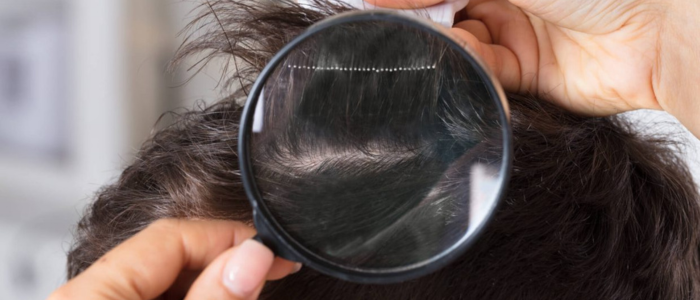 LE PROTESI DI CAPELLI SONO VISIBILI?