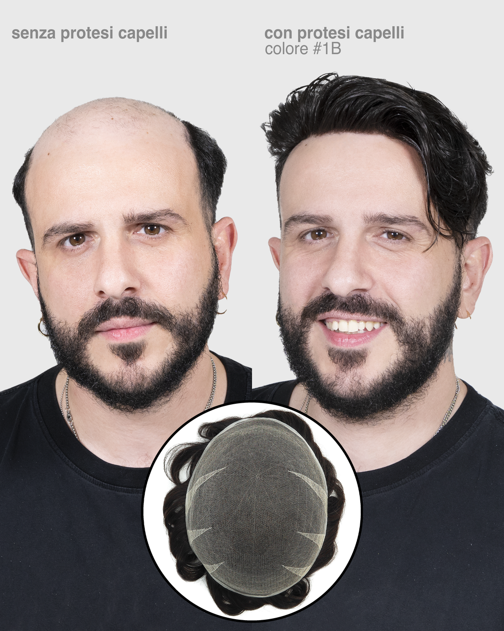 PROTESI CAPELLI AFRODITE