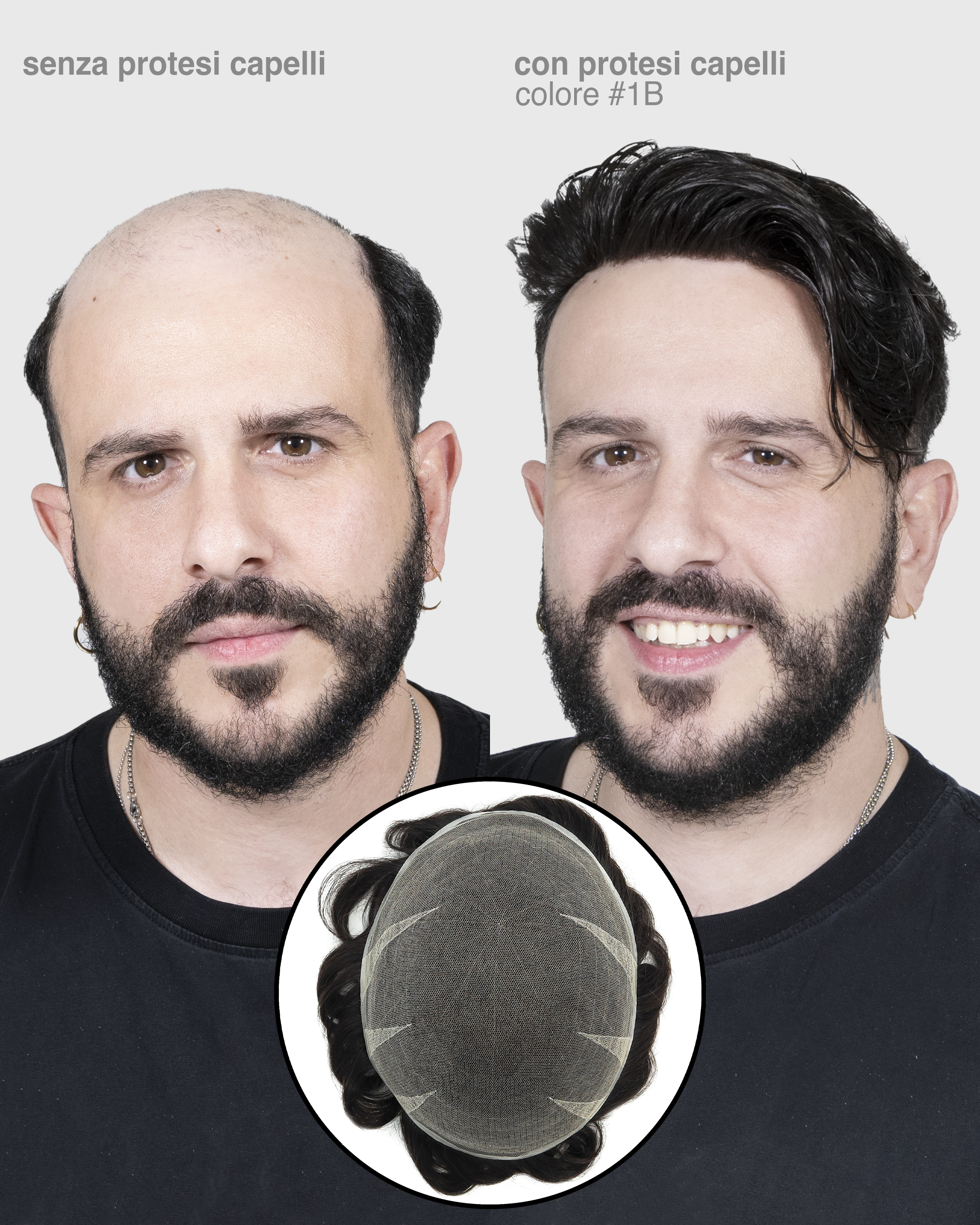 PROTESI CAPELLI AFRODITE