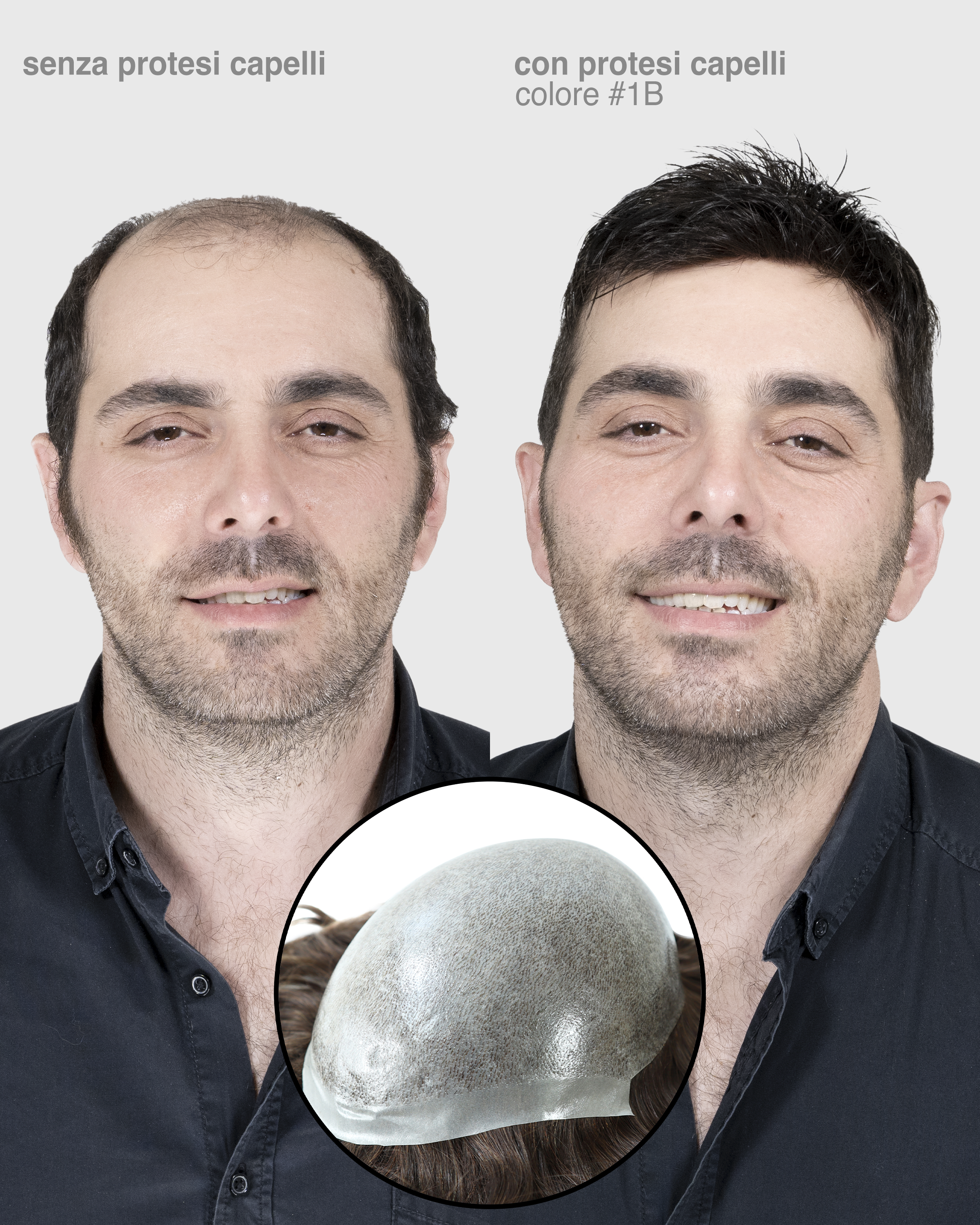 PROTESI CAPELLI ARTEMIDE