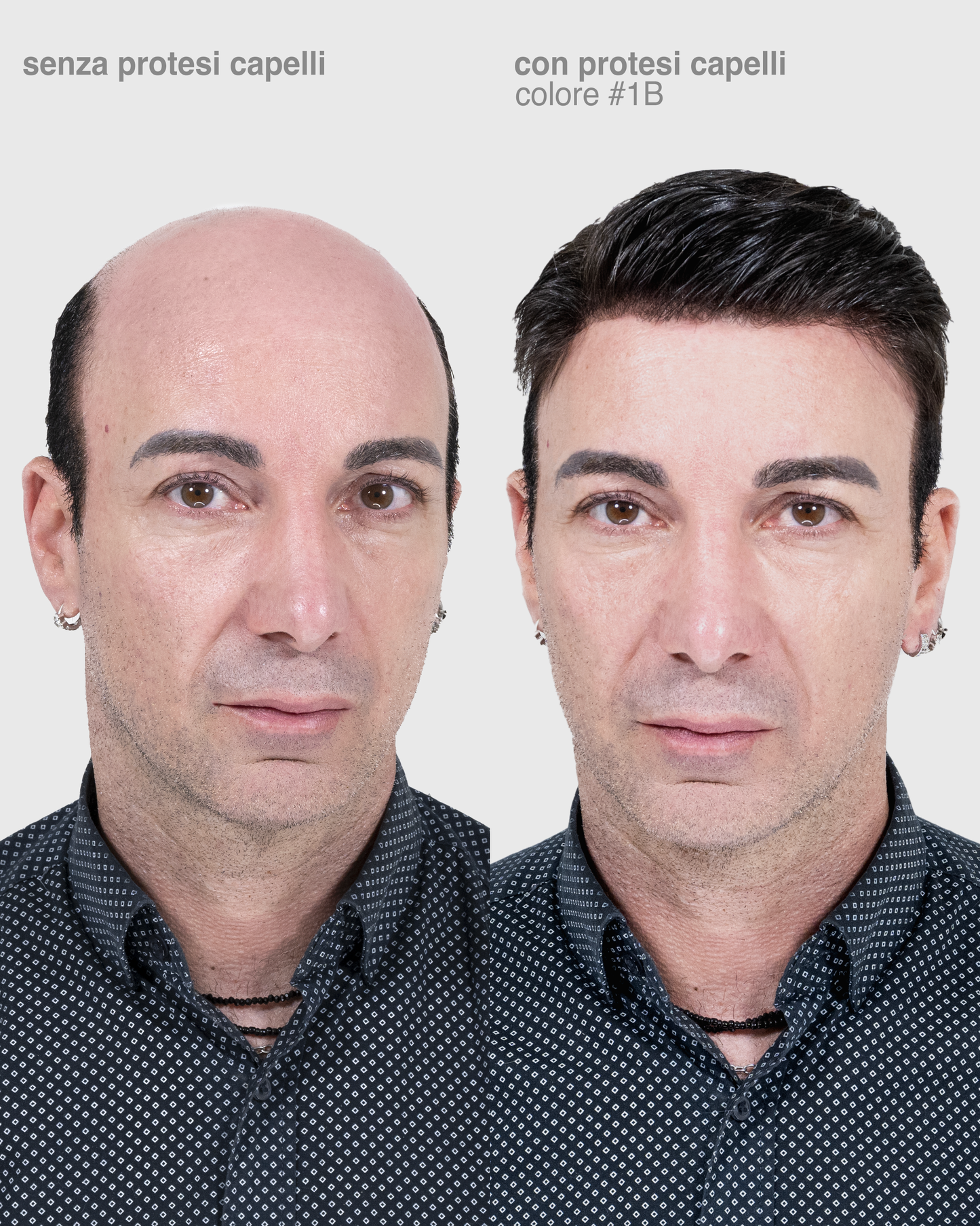 PROTESI CAPELLI ATENA