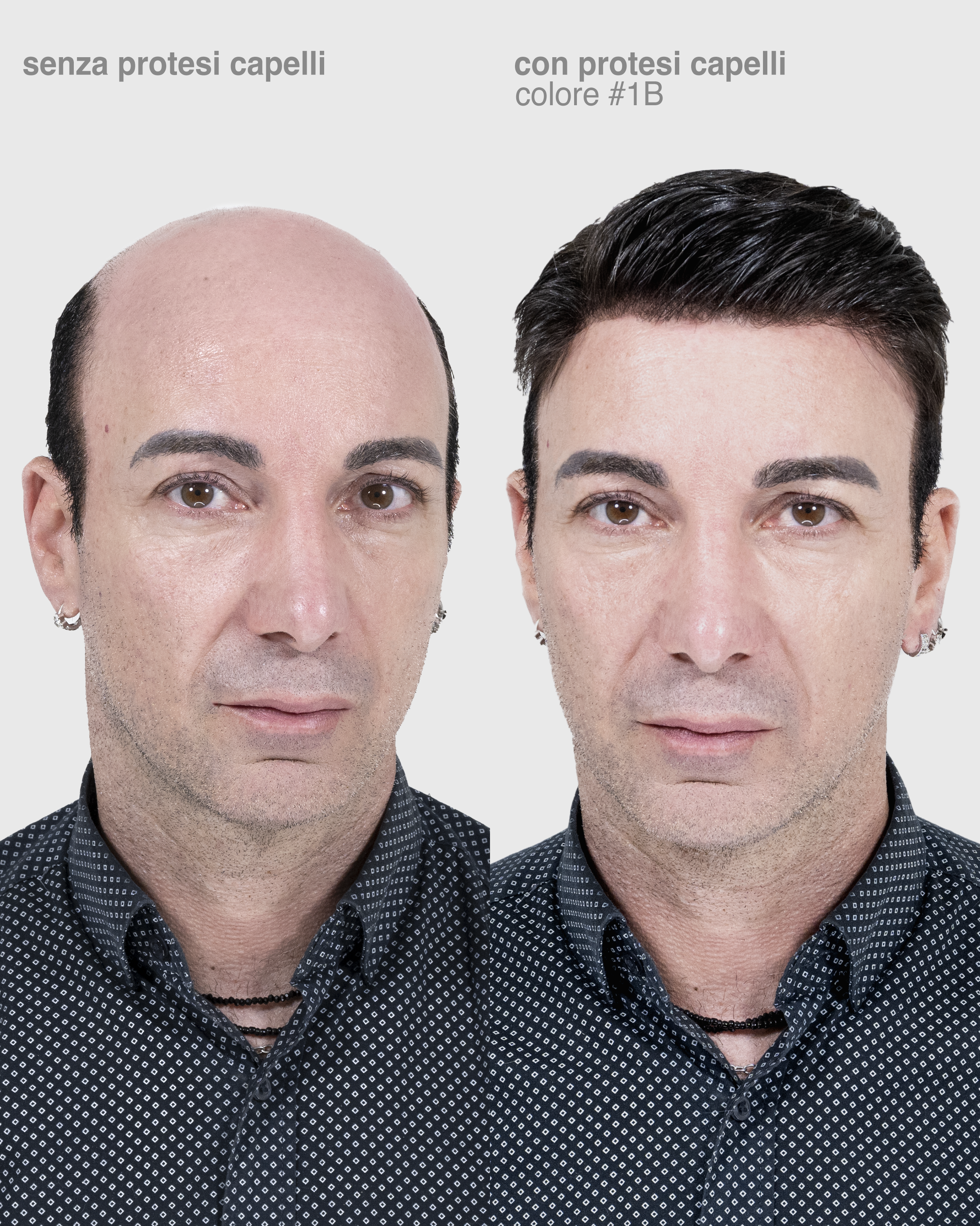 PROTESI CAPELLI ATENA