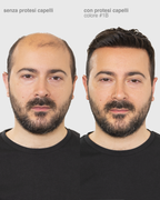 PROTESI CAPELLI BRONZE