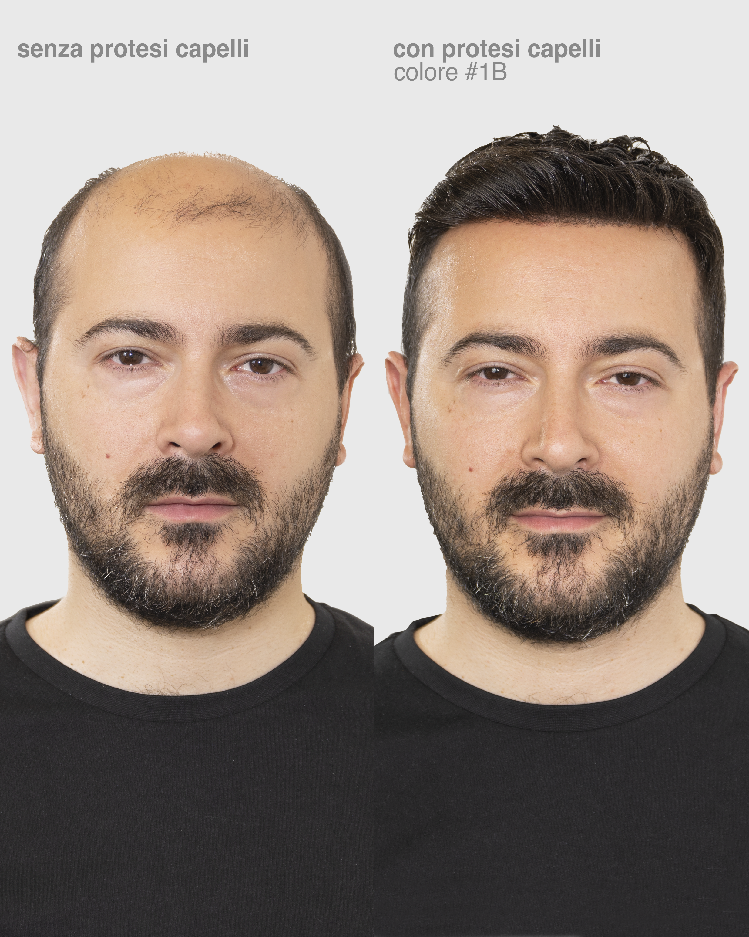 PROTESI CAPELLI BRONZE