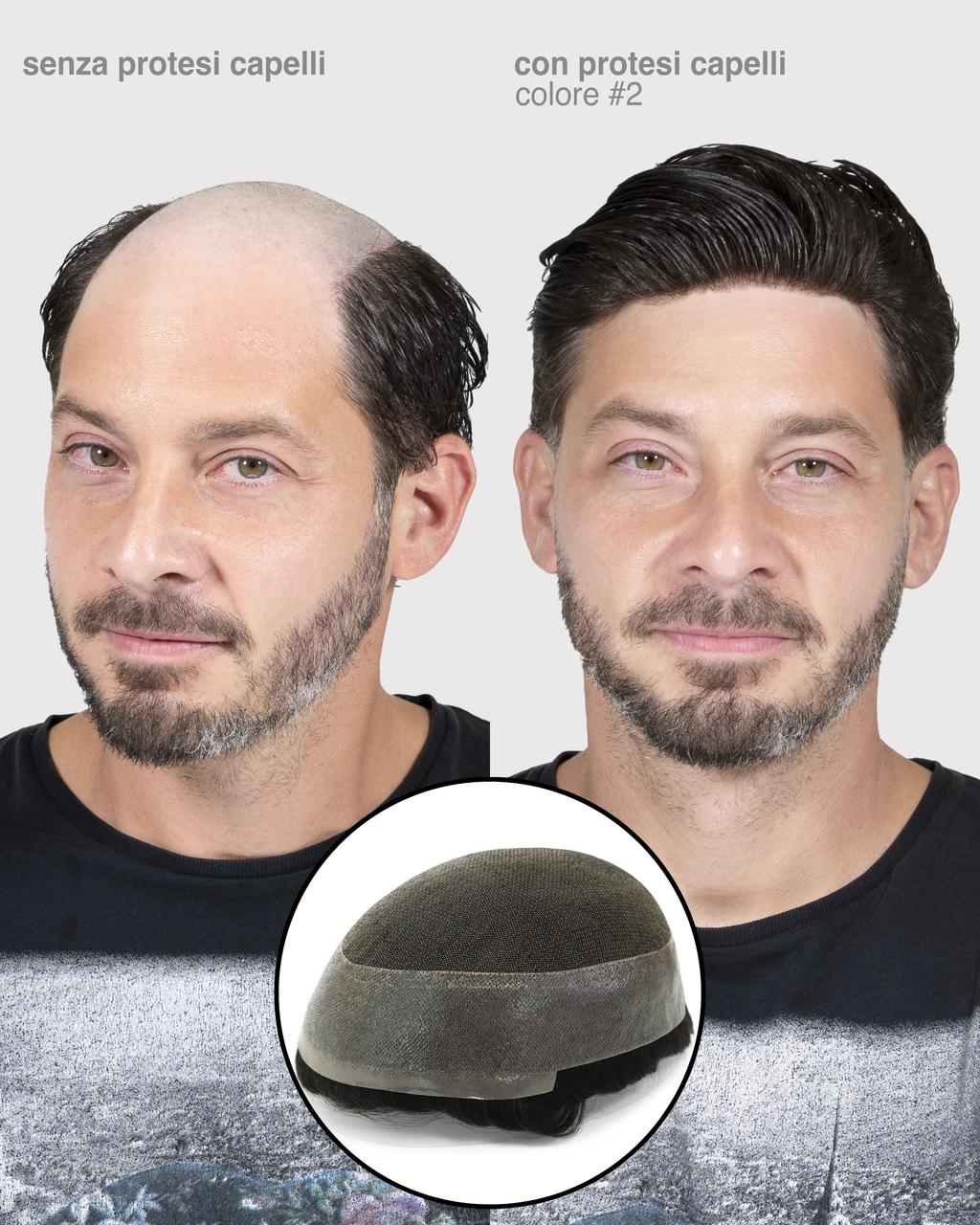 PROTESI CAPELLI DEMETRA