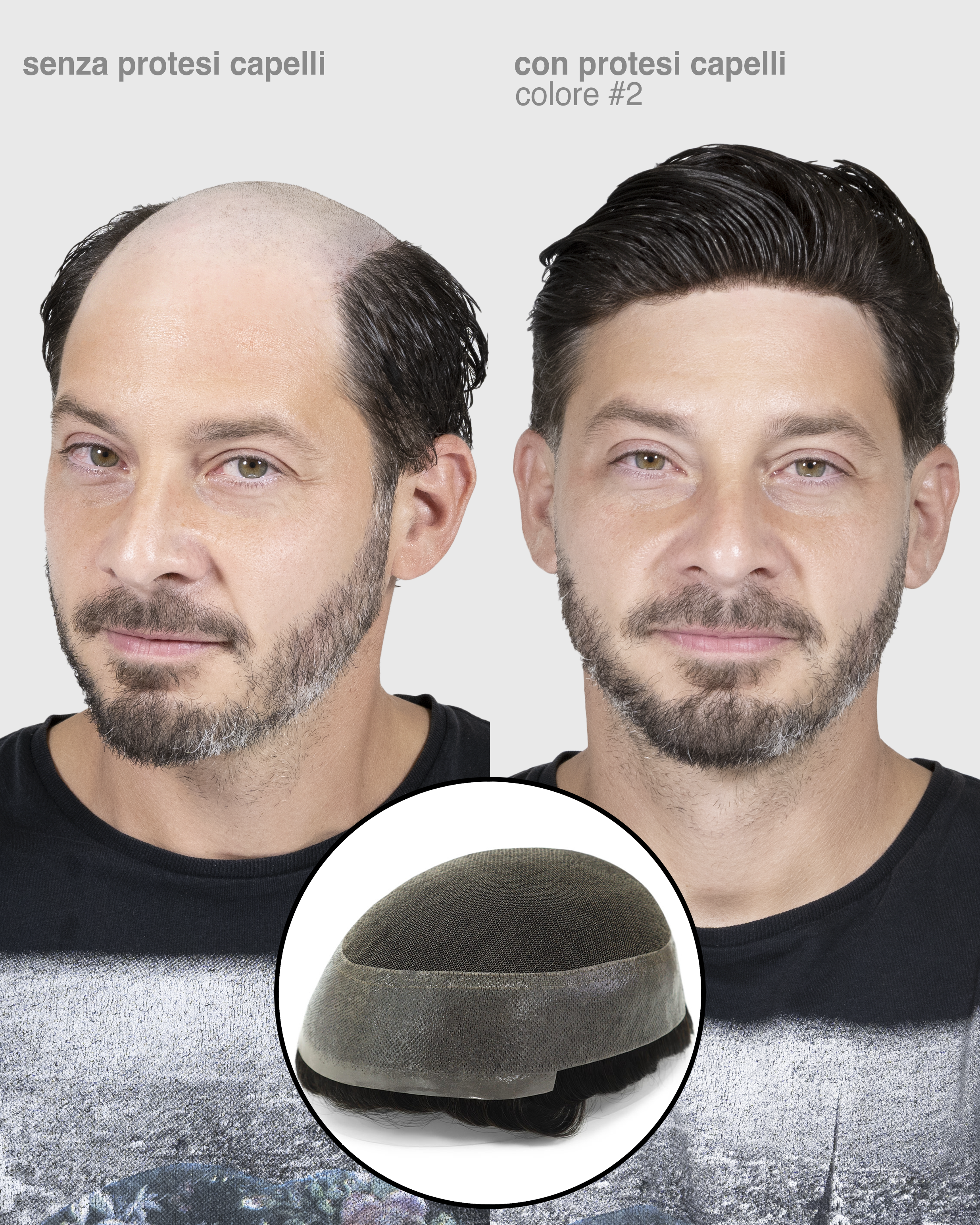 PROTESI CAPELLI DEMETRA