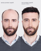 PROTESI CAPELLI GOLD