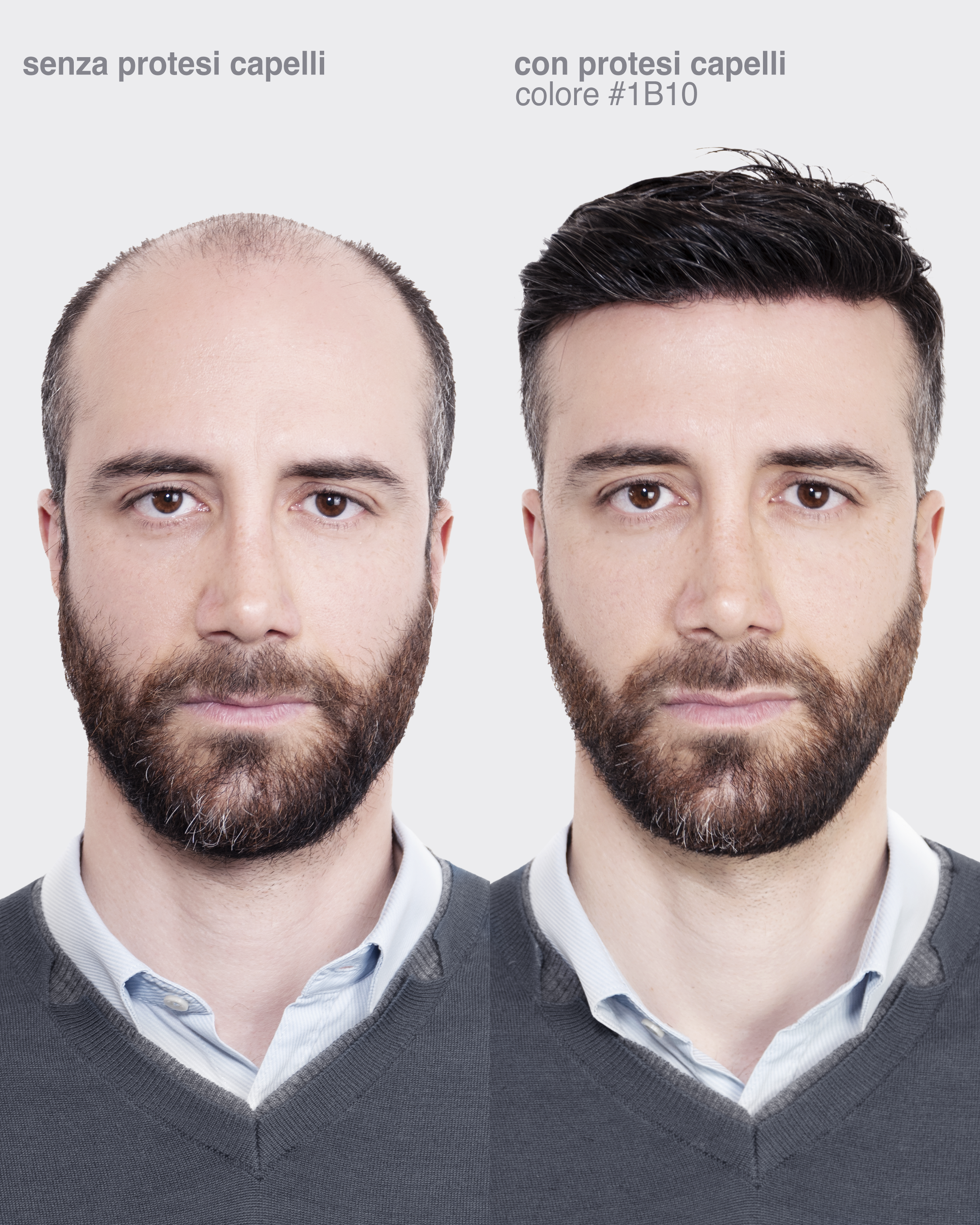 PROTESI CAPELLI GOLD