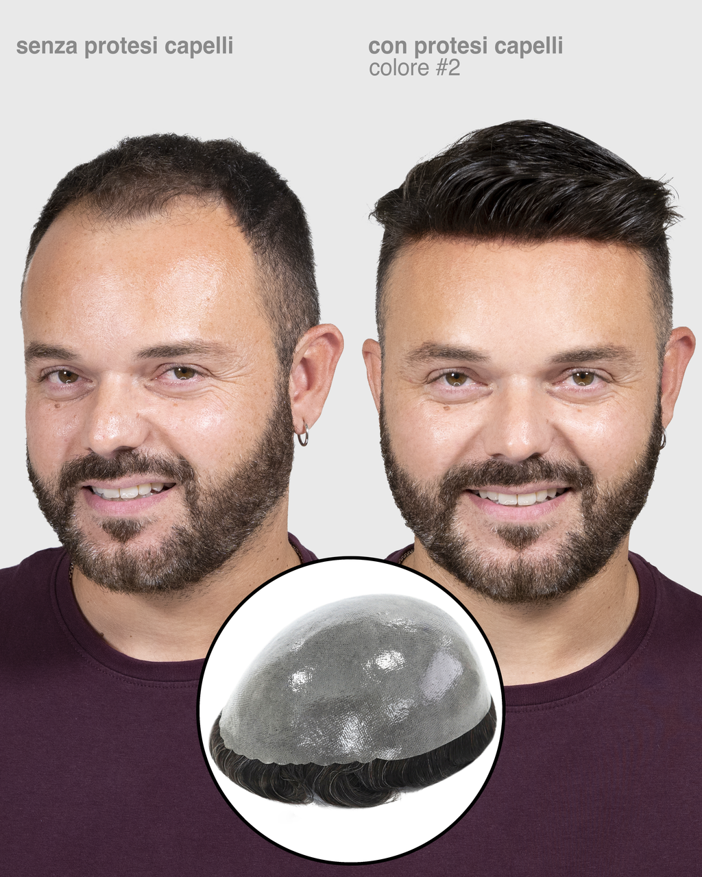 PROTESI CAPELLI POSEIDONE