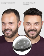 PROTESI CAPELLI POSEIDONE