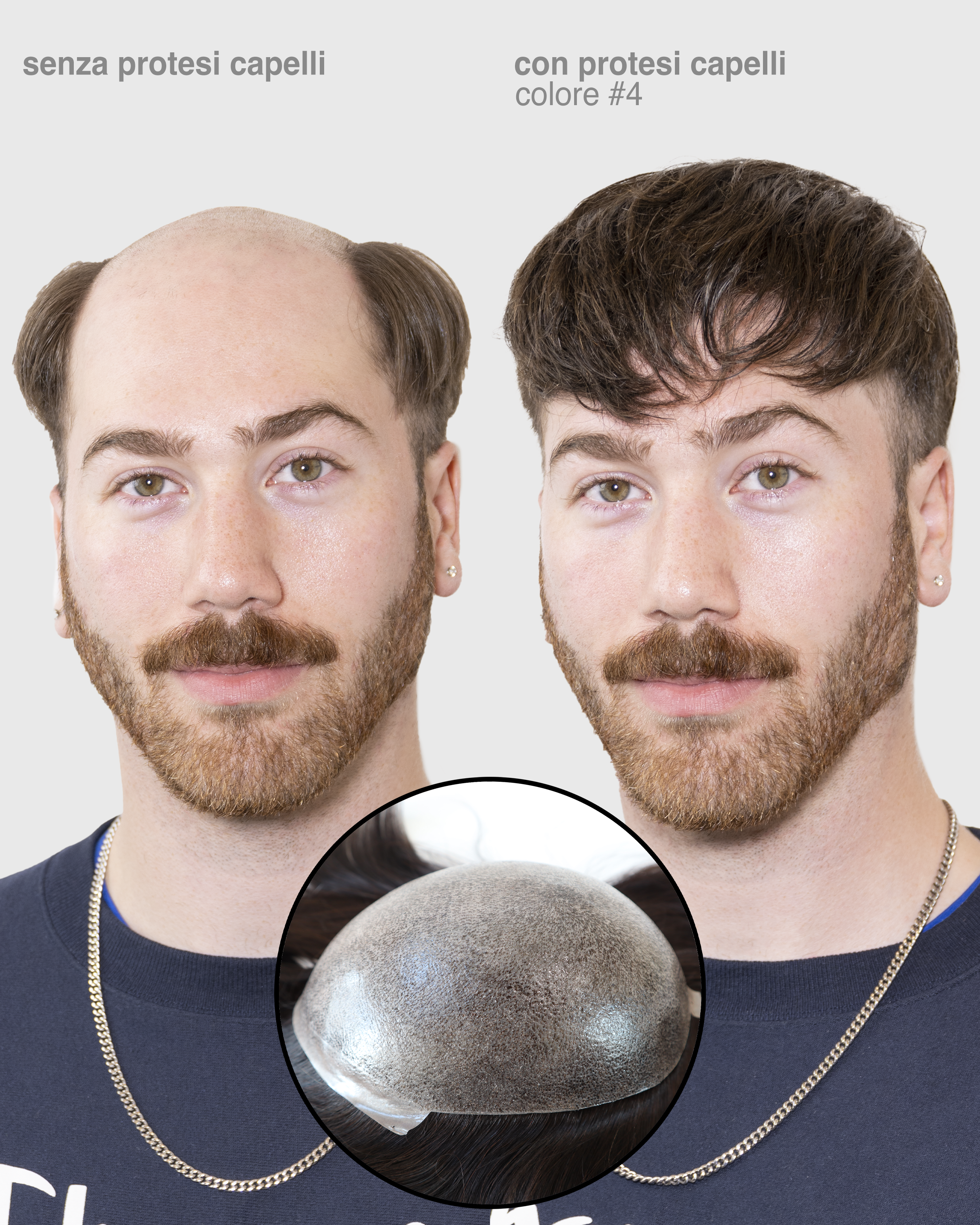 PROTESI CAPELLI ZEUS