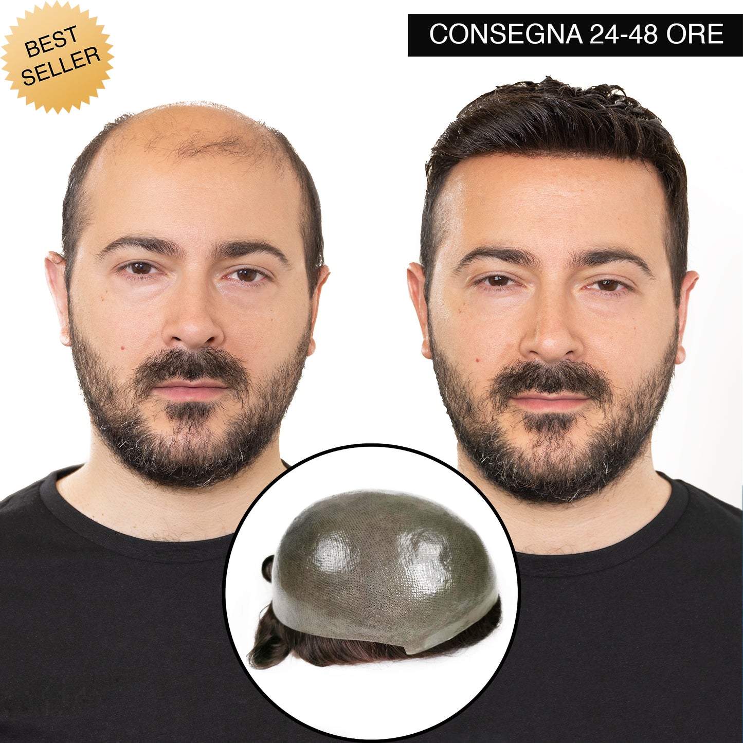 PROTESI CAPELLI BRONZE