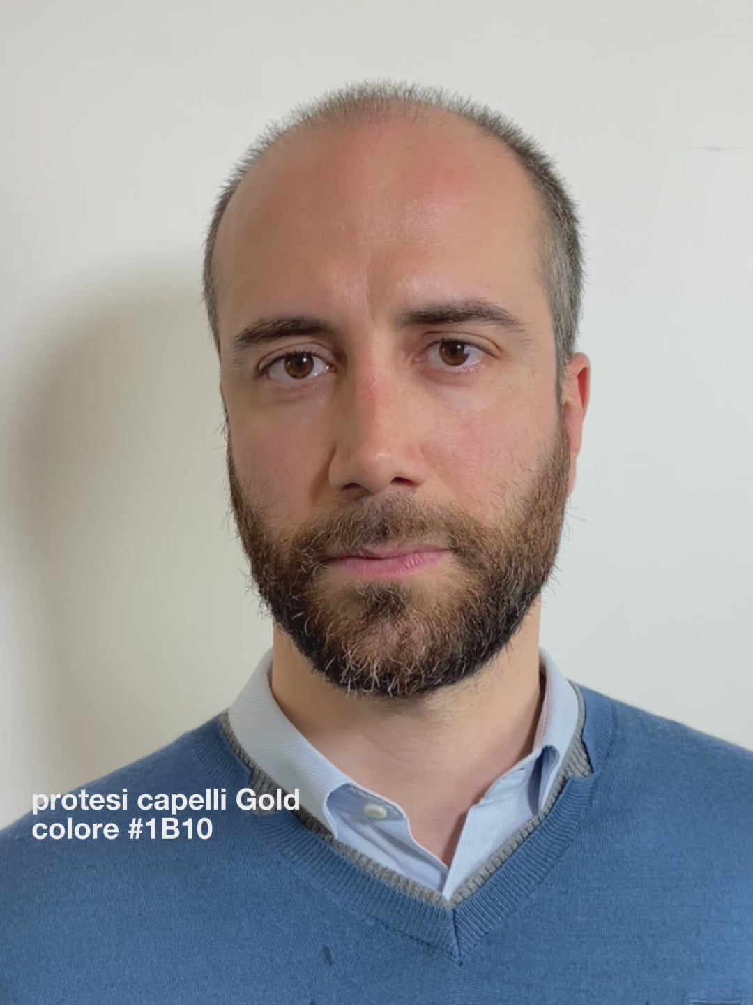 PROTESI CAPELLI GOLD