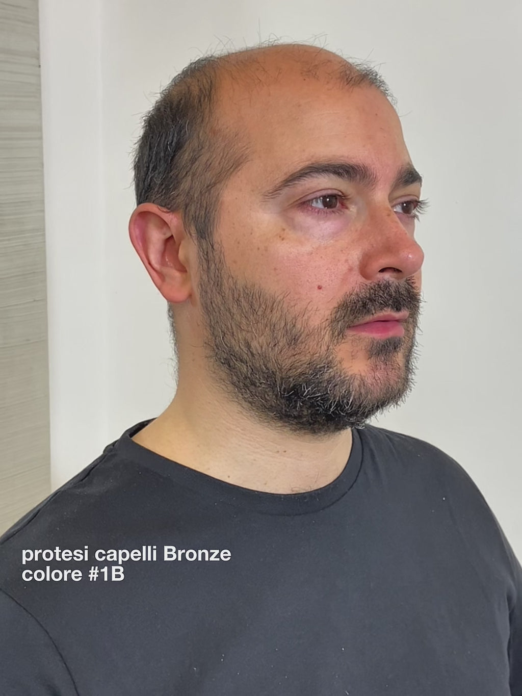 PROTESI CAPELLI BRONZE