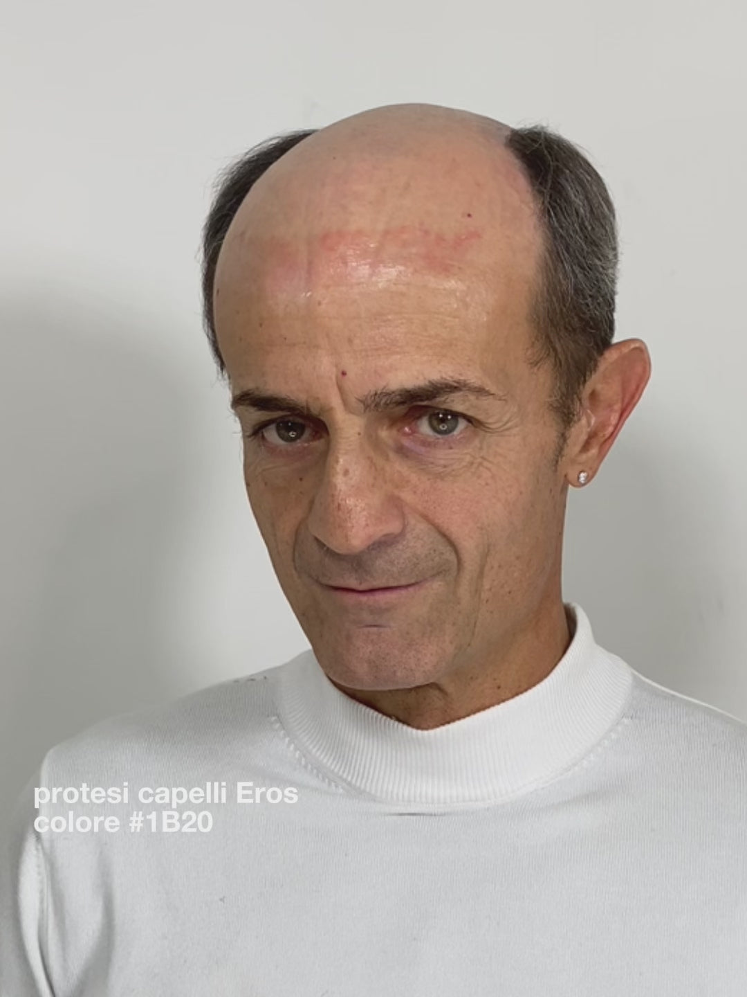 PROTESI CAPELLI EROS