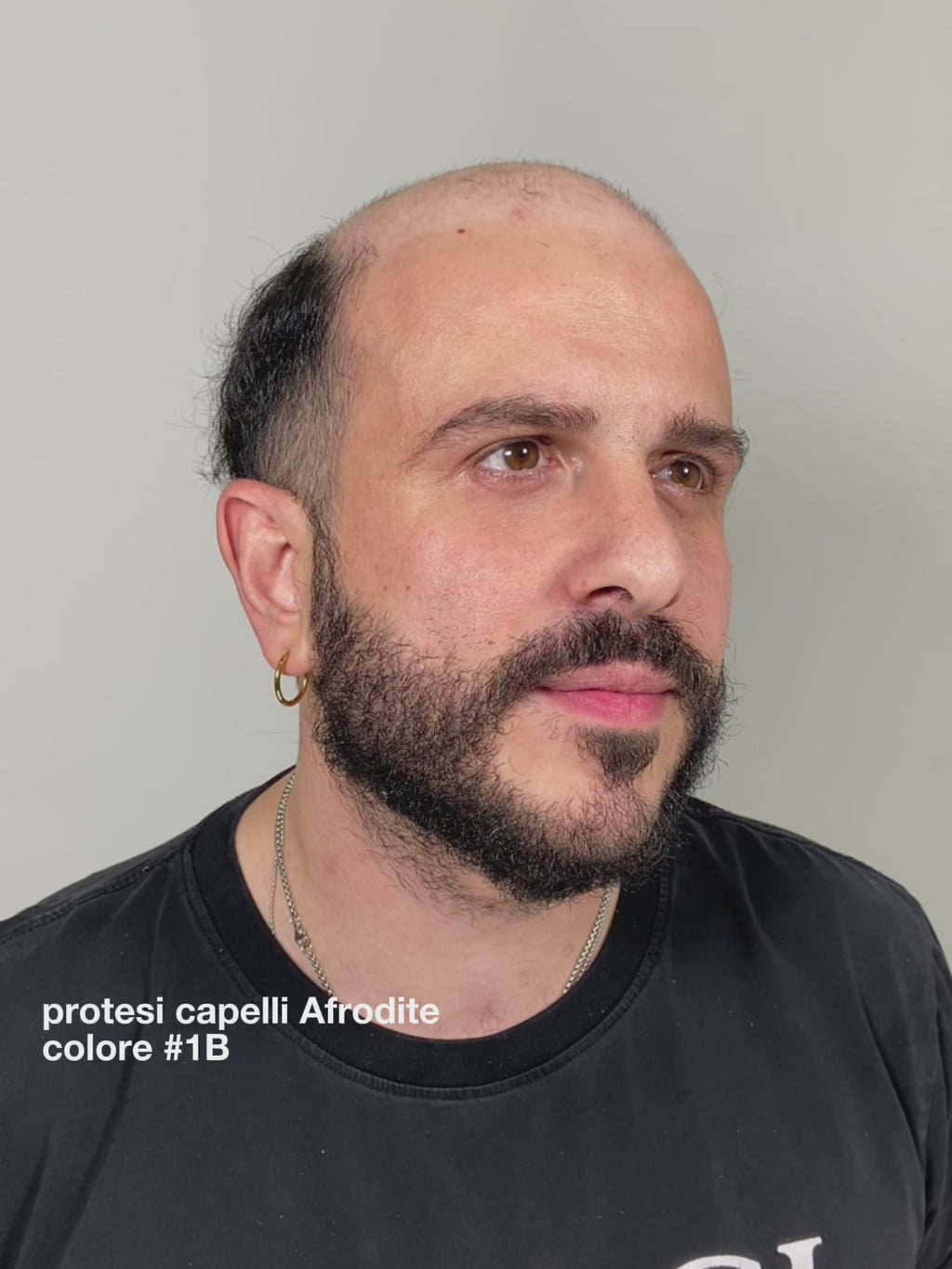 PROTESI CAPELLI AFRODITE