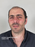 PROTESI CAPELLI ARTEMIDE